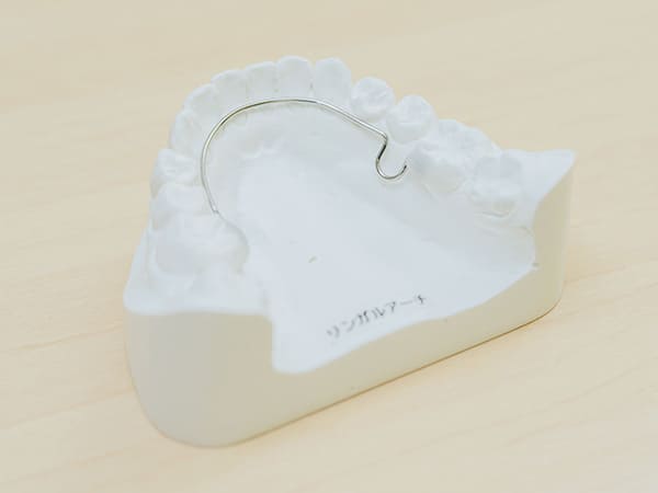 リンガルアーチ