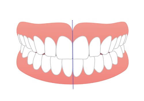 目指したい歯並びの基準