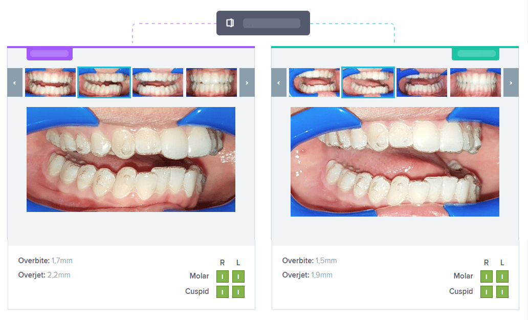 STEP-4