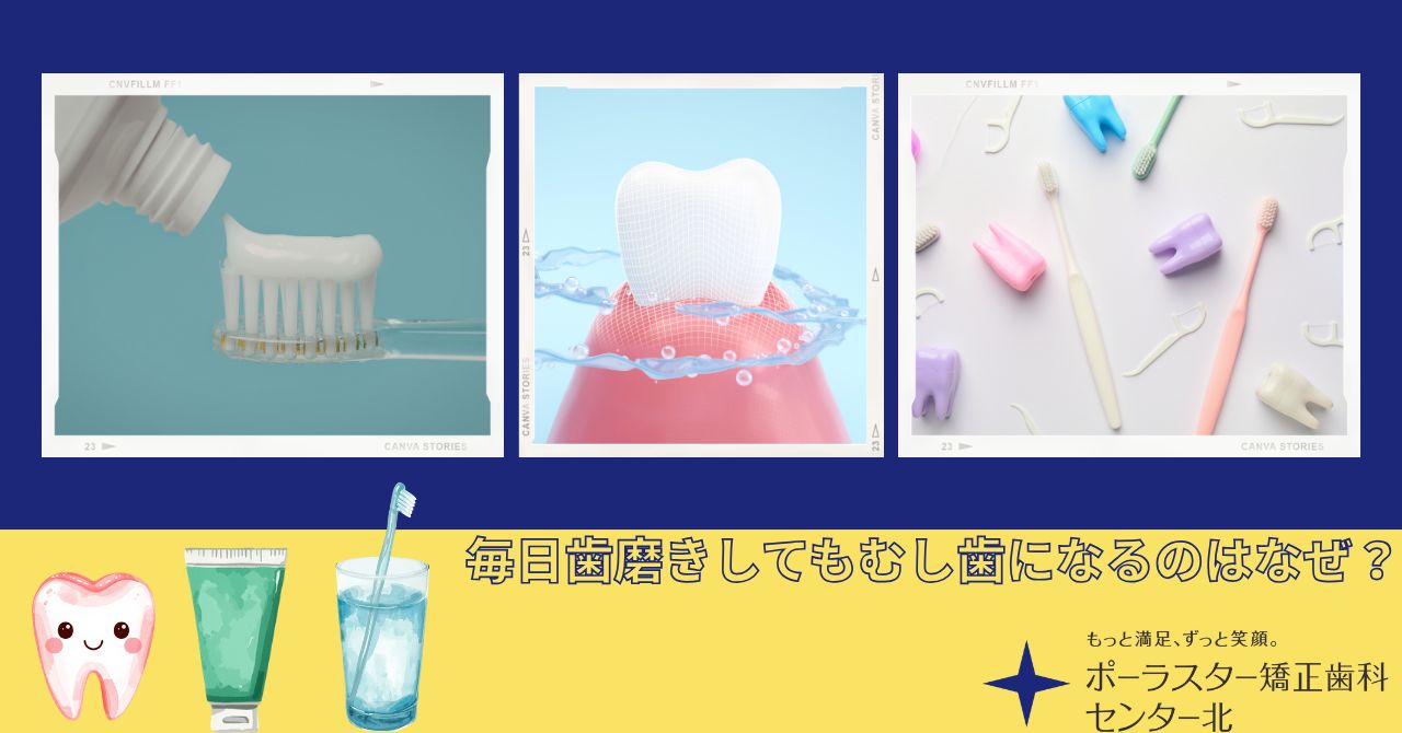 毎日歯磨きしているのに、なぜむし歯になるのか？