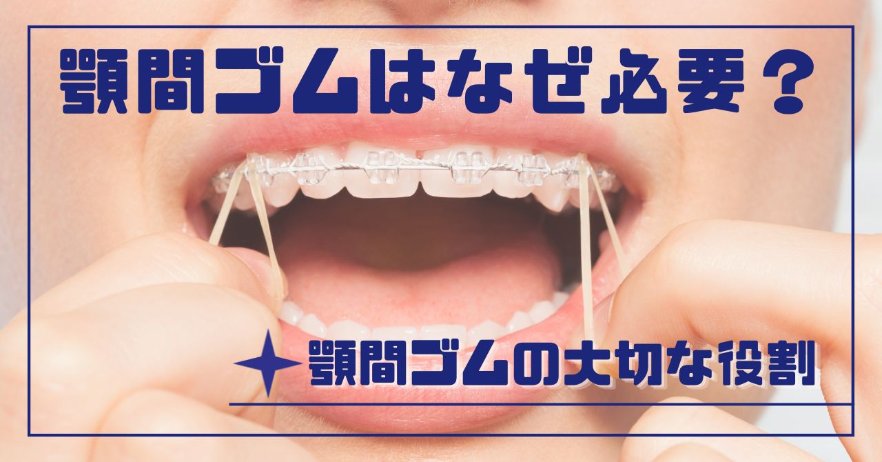 顎間ゴム（エラスティック）はなぜ必要？